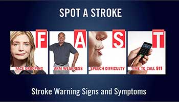 photo of stroke warning signs